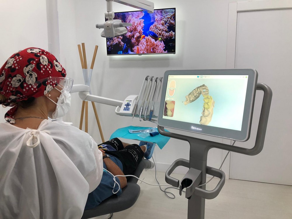 Clínica Dss incorpora el escaner intraoral 3D  iTERO Element